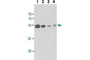 Western blot analysis of Lane 1: mouse brain tissue lysates Lane 2: Y79 whole cell lysates Lane 3: CEM whole cell lysates Lane 4: 293 whole cell lysates reacted with TUBB1 monoclonal antibody  at 1:100-1:500 dilution. (TUBB1 Antikörper)