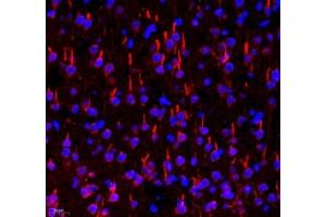 Immunofluorescent analysis of paraformaldehyde-fixed rat brain using TRIM46 (ABIN7076020) at dilution of 1: 3200 (TRIM46 Antikörper)