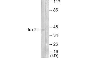 Western blot analysis of extracts from LOVO cells, using Fra-2 antibody (ABIN5976401). (FOSL2 Antikörper  (C-Term))