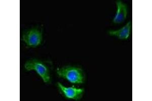Immunofluorescent analysis of A549 cells using ABIN7172144 at dilution of 1:100 and Alexa Fluor 488-congugated AffiniPure Goat Anti-Rabbit IgG(H+L) (THADA Antikörper  (AA 432-651))
