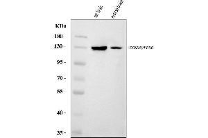 Western blot analysis of H-ERG/KCNH2 using anti-H-ERG/KCNH2 antibody (ABIN7599835).