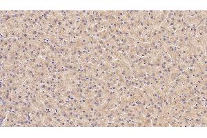 Immunohistochemistry (IHC) image for anti-Procollagen III N-Terminal Propeptide (PIIINP) antibody (ABIN7428533)
