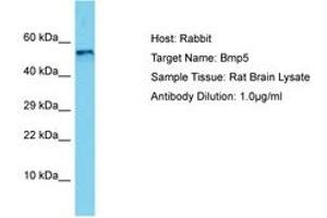 Image no. 1 for anti-Bone Morphogenetic Protein 5 (BMP5) (AA 327-376) antibody (ABIN6750503) (BMP5 Antikörper  (AA 327-376))
