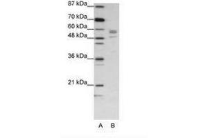 Image no. 1 for anti-Serine--tRNA Ligase, Cytoplasmic-Like (C-Term) antibody (ABIN202697) (Serine--tRNA Ligase, Cytoplasmic-Like (C-Term) Antikörper)
