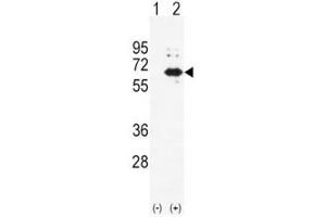 Western blot analysis of Alkaline Phosphatase antibody and 293 cell lysate (2 ug/lane) either nontransfected (Lane 1) or transiently transfected (2) with the ALPL gene. (ALPL Antikörper  (AA 217-246))