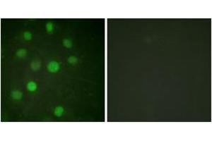 Immunofluorescence analysis of HuvEc cells, using Histone H1 (Ab-17) Antibody. (Histone H1 Antikörper  (AA 1-50))