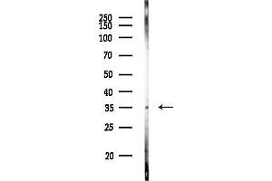 anti-Microtubule-Associated Protein, RP/EB Family, Member 1 (MAPRE1) (Internal Region) antibody