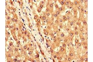 Immunohistochemistry of paraffin-embedded human liver tissue using ABIN7145021 at dilution of 1:100 (KCNJ11 Antikörper  (AA 172-390))