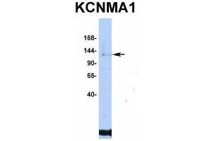 Host:  Rabbit  Target Name:  KCNMA1  Sample Type:  Jurkat  Antibody Dilution:  1. (KCNMA1 Antikörper  (C-Term))
