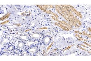 Detection of ACTC1 in Human Stomach Tissue using Monoclonal Antibody to Actin Alpha 1, Cardiac Muscle (ACTC1) (ACTC1 Antikörper  (AA 156-368))