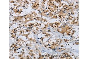 Immunohistochemistry of Human brain  using CMTM8 Polyclonal Antibody at dilution of 1:40 (CMTM8 Antikörper)