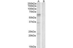 Western Blotting (WB) image for anti-Solute Carrier Family 7 (Cationic Amino Acid Transporter, Y+ System), Member 5 (SLC7A5) (Internal Region) antibody (ABIN2464279) (SLC7A5 Antikörper  (Internal Region))
