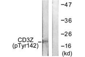 Western blot analysis of extracts from Jurkat cells treated with UV 15', using CD3 zeta (Phospho-Tyr142) Antibody. (CD247 Antikörper  (pTyr142))