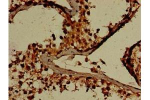 Immunohistochemistry of paraffin-embedded human testis tissue using ABIN7154194 at dilution of 1:100 (GARS Antikörper  (AA 1-389))