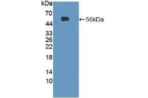 Detection of Recombinant SESN1, Mouse using Polyclonal Antibody to Sestrin 1 (SESN1)