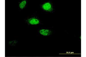 Immunofluorescence of monoclonal antibody to RNF207 on HeLa cell. (RNF207 Antikörper  (AA 135-244))