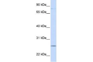 WB Suggested Anti-PCDHGC3 Antibody Titration:  0. (Protocadherin gamma Subfamily C, 3 (PCDHGC3) (N-Term) Antikörper)