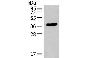 Western blot analysis of HEPG2 cell lysate using ACBD4 Polyclonal Antibody at dilution of 1:400 (ACBD4 Antikörper)