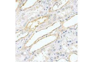 Immunohistochemistry of paraffin-embedded human kidney using Prostatic Acid Phosphatase (ACPP) Rabbit pAb (ABIN3022671, ABIN3022672, ABIN3022673 and ABIN6219082) at dilution of 1:50 (40x lens). (ACPP Antikörper  (AA 40-300))
