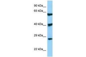 Image no. 1 for anti-DKK3 (AA 51-100) antibody (ABIN6748413) (DKK3 Antikörper  (AA 51-100))