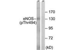 Western blot analysis of extracts from Jurkat cells, using eNOS (Phospho-Thr494) Antibody. (ENOS Antikörper  (pThr495))