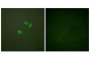 Immunofluorescence analysis of NIH/3T3 cells, using Sumo1 antibody. (SUMO1 Antikörper  (N-Term))