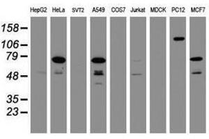 Image no. 2 for anti-Receptor (TNFRSF)-Interacting serine-threonine Kinase 1 (RIPK1) (AA 133-422) antibody (ABIN1490912) (RIPK1 Antikörper  (AA 133-422))