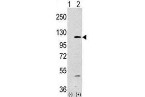 Western blot analysis of PI3KCA antibody and 293 lysate transiently transfected with the PIK3CA gene (1ug/lane).