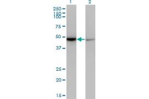 Western Blot analysis of NR0B1 expression in transfected 293T cell line by NR0B1 monoclonal antibody (M07), clone 3G8. (NR0B1 Antikörper  (AA 361-470))