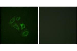 Immunofluorescence analysis of HepG2 cells, using c-Met (Phospho-Tyr1003) antibody. (c-MET Antikörper  (pTyr1003))