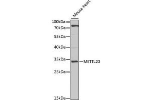 Western blot analysis of extracts of mouse heart, using METTL20 antibody (ABIN2563850) at 1:1000 dilution. (METTL20 Antikörper)