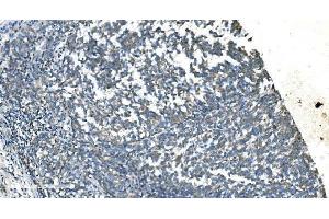 IHC analysis of TIMM8A/DDP using anti-TIMM8A/DDP antibody (ABIN7600039). (TIMM8A/DDP Antikörper  (AA 14-97))