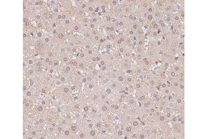 Immunohistochemistry of paraffin-embedded Rat liver using HSF1 Polyclonal Antibody at dilution of 1:100 (40x lens). (HSF1 Antikörper)