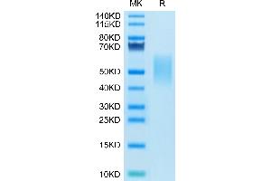 SDS-PAGE (SDS) image for Hepatitis A Virus Cellular Receptor 2 (TIM 3) (AA 22-191) protein (His tag) (ABIN7275740)