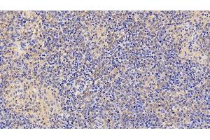 Immunohistochemistry (IHC) image for anti-Interleukin 6 Receptor (IL6R) (AA 216-356) antibody (ABIN7434104)