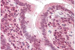 Human Small Intestine (formalin-fixed, paraffin-embedded) stained with POLL antibody ABIN337014 at 5 ug/ml followed by biotinylated anti-goat IgG secondary antibody ABIN481715, alkaline phosphatase-streptavidin and chromogen. (POLL Antikörper  (AA 563-575))