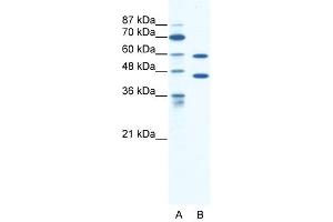 CATSPER2 antibody used at 1.