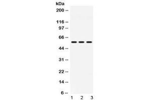 Western blot testing of 1) rat lung, 2) mouse spleen and 3) human MCF7 lysate with MPP1 antibody at 0. (MPP1 Antikörper  (AA 409-450))