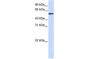 WB Suggested Anti-TADA3L Antibody Titration:  0. (TADA3L Antikörper  (Middle Region))