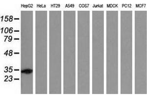 Western blot analysis of extracts (35 µg) from 9 different cell lines by using anti-SULT2A1 monoclonal antibody.