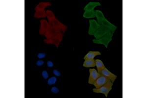 anti-ELAV2/4 (ELAV2/4) antibody