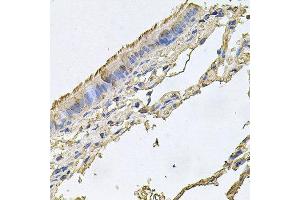 Immunohistochemistry of paraffin-embedded human trachea using FABP12 antibody at dilution of 1:100 (x40 lens). (FABP12 Antikörper)