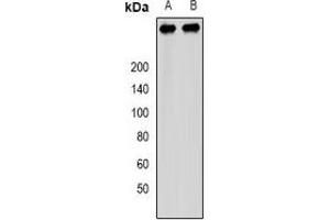 Western blot analysis of PCM1 expression in SW480 (A), 293T (B) whole cell lysates. (PCM1 Antikörper)