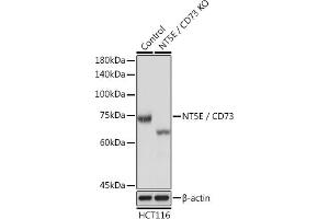 Western blot analysis of extracts from normal (control) and CD73/NT5E Rabbit pAb knockout (KO) HCT116 cells, using CD73/NT5E Rabbit pAb antibody (ABIN3022733, ABIN3022734, ABIN3022735, ABIN1513283 and ABIN6219201) at 1:3000 dilution. (CD73 Antikörper  (AA 290-550))