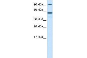 WB Suggested Anti-SEPT4 Titration:  0. (Septin 4 Antikörper  (N-Term))