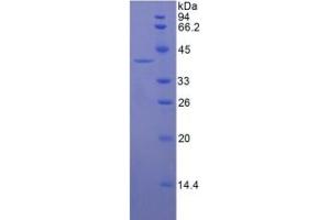 SDS-PAGE of Protein Standard from the Kit (Highly purified E. (KRT16 ELISA Kit)