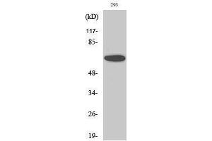 Western Blotting (WB) image for anti-SUMO1 Activating Enzyme Subunit 2 (UBA2) (C-Term) antibody (ABIN3187391)