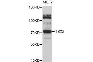 Western blot analysis of extract of MCF7 cells, using TBX2 antibody. (TBX2 Antikörper)
