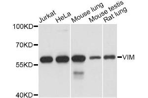 Western blot analysis of extracts of various cell lines, using VIM antibody. (Vimentin Antikörper  (AA 1-101))