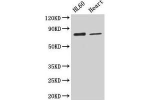 Western Blot Positive WB detected in: HL60 whole cell lysate, Mouse heart tissue All lanes: CAST antibody at 2. (Calpastatin Antikörper  (AA 1-667))